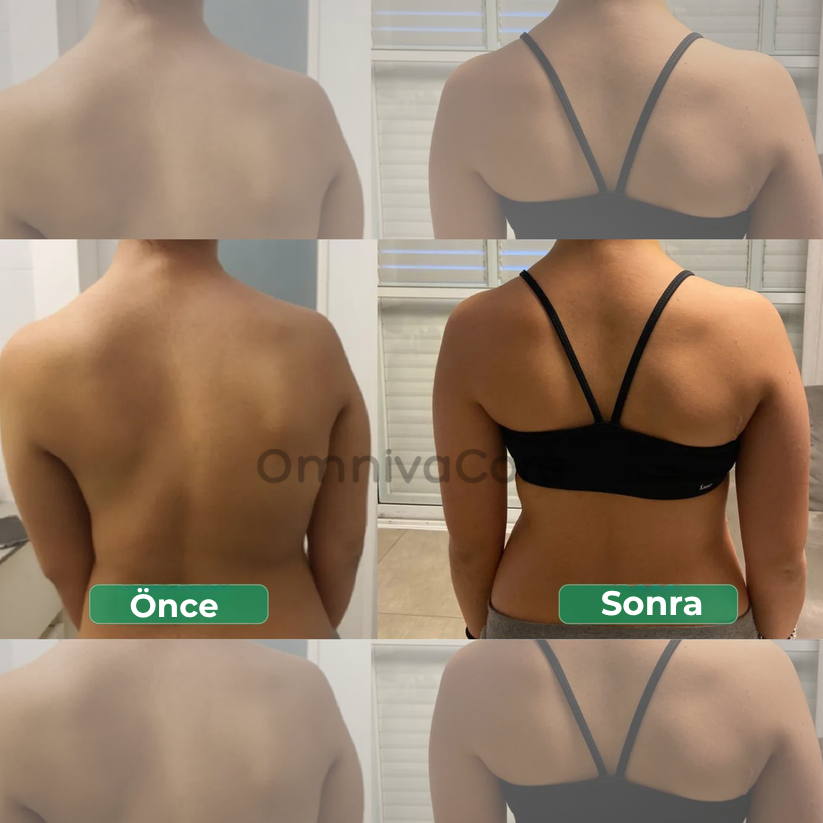 Ayarlanabilir Dik Duruş Korsesi