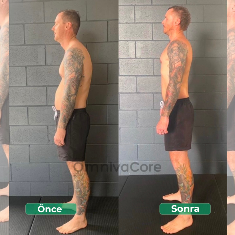 Ayarlanabilir Dik Duruş Korsesi