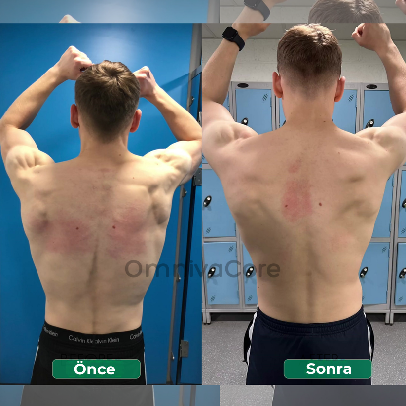 Ayarlanabilir Dik Duruş Korsesi